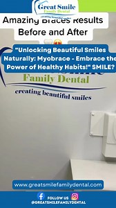 The Myobrace System focuses on correcting orthodontic issues in children between the ages of 5 and 15. 👨👨👨👨👨 By addressing concerns early on, we can guide proper jaw and dental development, reducing the need for more extensive orthodontic treatments in the future. If you're interested in learning more about the Myobrace System and its potential benefits for your child, we invite you to schedule a consultation with our experienced dental team. We'll assess your child's orthodontic needs and 
