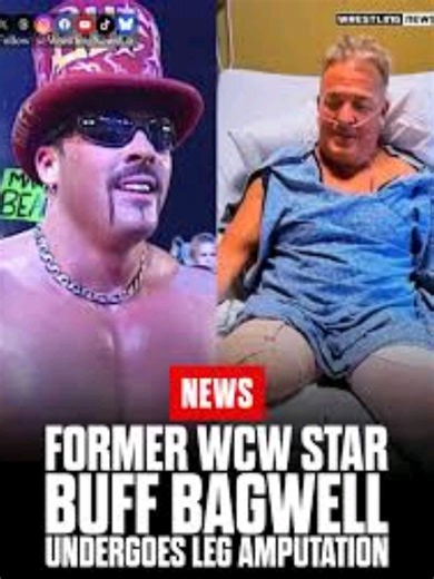Buff Bagwell's Inspiring Journey After Amputation