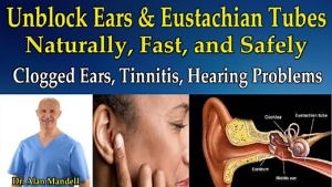 Unblock Ears and Eustachian Tubes Naturally (Clogged Ears, Tinnitis, Hearing Problems) – Dr Mandell