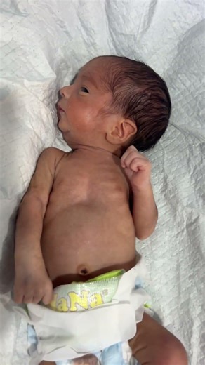 Preterm Baby Observation 😔🍼👶 | NICU Care & Monitoring ♥️ #PretermBaby #NICUBaby