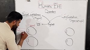 نظر ولی کمزوری کیگی؟ Short Shightedness & Long Sightedness explained by Tariq Pathan | Tariq Pathan Science Academy