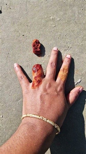 extra finger edd #but it's viral finger magic shorts funny magic tricks tutorial for fun only