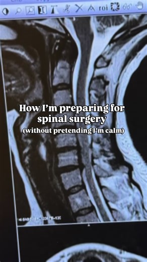 Spinal surgery prep has turned me into the most chaotic version of myself and somehow it feels on brand. I’m having ACDF with corpectomy on Monday, which basically means fixing the part of my spine that’s been crushing my spinal cord so I can hopefully get my life back. It’s huge and serious, and yet I’m still over here drinking immunity shots like cocktails and panic-cleaning my house for no reason. The timing? Three days before Christmas. So I’ve been finishing every client at the salon, wrapp