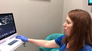 1.8K views · 15 reactions | Ganglion cyst. Ganglion cysts can occur...