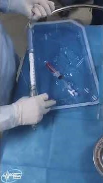 EUS-FNA (Endoscopic Ultrasound guided Fine Needle Aspiration) || Dr.sun #endoscopy