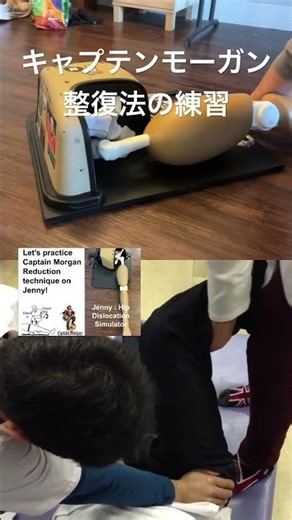股関節後方脱臼 : キャプテンモーガン整復法の練習！ 患者さんなしで何回でも！