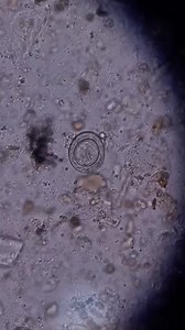 13K views · 230 reactions | Stool sample  #lablife. #microbiology | Lab life | Facebook