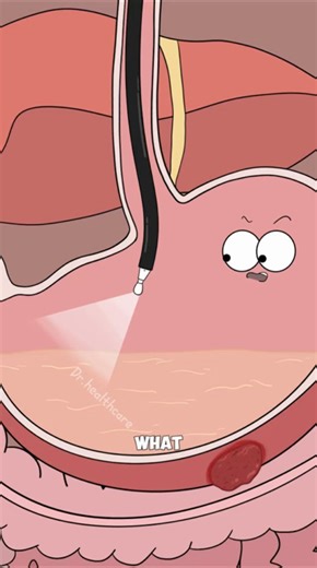 They Found a Tumor Using This Device