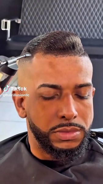 Achieve a Flawless Hairline with Hair Illusion