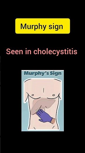 #common Medical sign #murphy sign #diagnosis #pharmcology