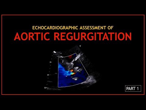 Echocardiographic Assessment of: AORTIC REGURGITATION (Part 1)