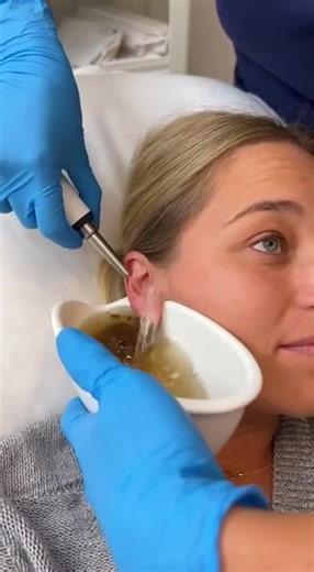 Effective Earwax Removal Tips and Tools