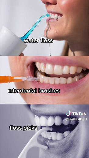 To keep your teeth healthy, be sure to follow these 4 simple steps: 🦷brushing twice each day with a fluoride toothpaste 🦷🦷floss and/or cleaning between teeth at least once a day 🦷🦷🦷use a tongue scraper at least once a day 🦷🦷🦷🦷drink water throughout the day to minimize the contact time acidic foods & drinks have on your teeth and to help neutralize your mouth #dentalhygiene #dentalhealth #dentalhygienist