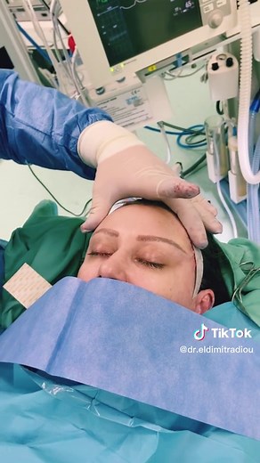 🆙Με το κροταφικό lift ή temporal lift ανασηκώνουμε τα φρύδια και δίνουμε μία νεανική εμφάνιση στην ασθενή. Ο χρόνος αποκατάστασης μικρός και η διάρκεια της επέμβασης εξαιρετικά σύντομη. #dreleftheriosdimitradiou #luxuriousmedicalaesthetics #cosmeticsurgery #temporallift #facelift #facelifting