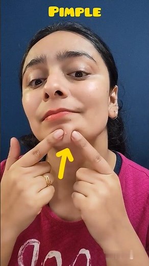 1 Day Challenge: Remove Pimples Fast At Home😳 #shorts #skincare #pimple #acne #clearskin #trending