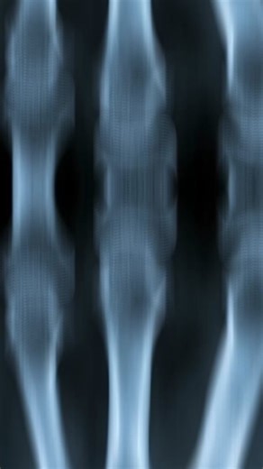 How Do X-Rays Work? #science #thedeepdive #history