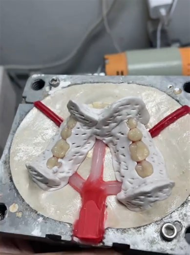 Cómo realizar una prótesis dental flexible: paso a paso