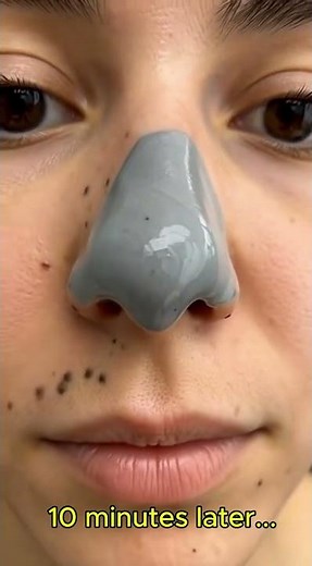 Satisfying Nose Pore Cleansing: Gray Clay Mask Before & After Results #skincare #skin #beauty