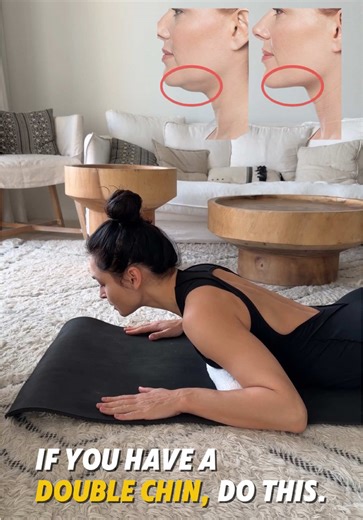 Understanding Double Chin Causes and Solutions