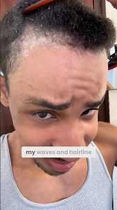 Trying to Fix My Hair Before 2026