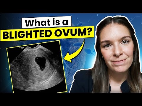 Understanding Blighted Ovum: Signs, Diagnosis, and Management