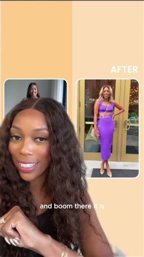 SHOCKING Liposuction Results After 3 Months!