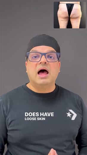 Bye Cellulite! Aveli Treatment Explained ‪@aestheticandcosmeticsurgeons‬