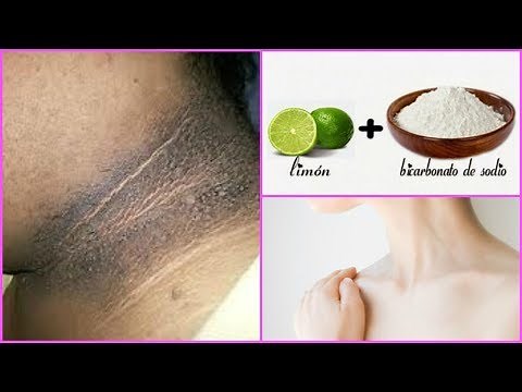 HOW TO REMOVE BLACK FROM THE NECK NATURALLY