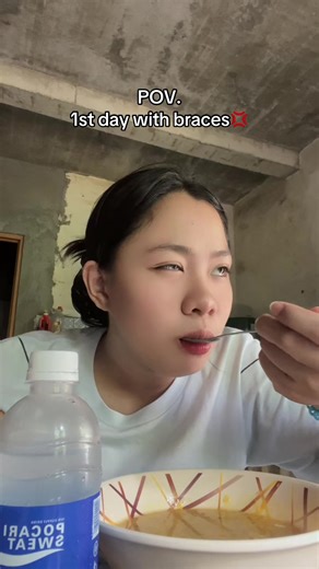 First Day with Braces: What to Expect