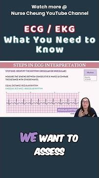 ECG Interpretation: How to Tell If Your Heartbeat is Regular! #shorts