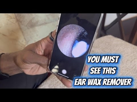 See The Features Of This Ear Wax Remover A Must Have Tool