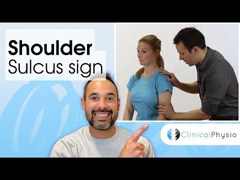Sulcus Sign | Clinical Physio