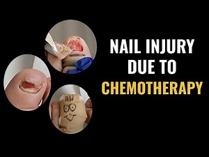 Nail injury due to chemotherapy