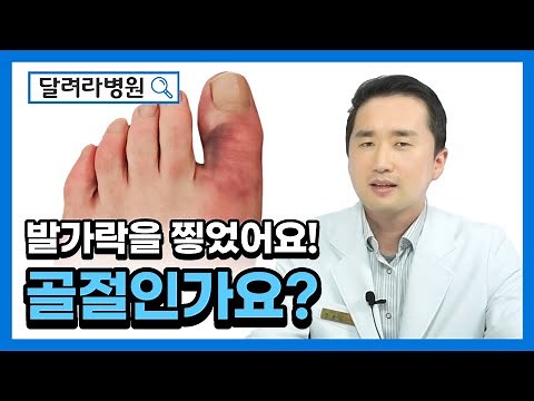 발가락을 찧었어요! 골절인가요? #발가락 골절 @달려라병원 김동은 원장