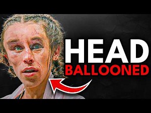 She Was Unstoppable — Until Her Face Exploded!