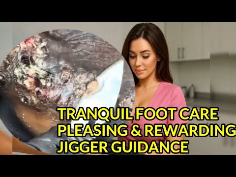 Tranquil Foot Care | Pleasing & Rewarding Jigger Guidance