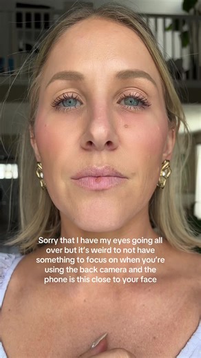 Lip Update Post-Skin Cancer Treatment