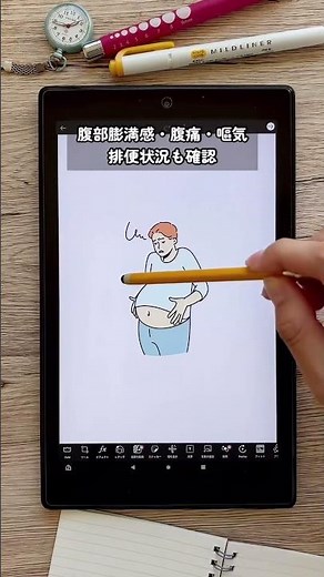 【知らないとやばい！腸蠕動コレ何？】#医療#消化器#外科#看護#看護師#看護師2年目#新人看護師 #看護師勉強垢#腸蠕動 #イレウス