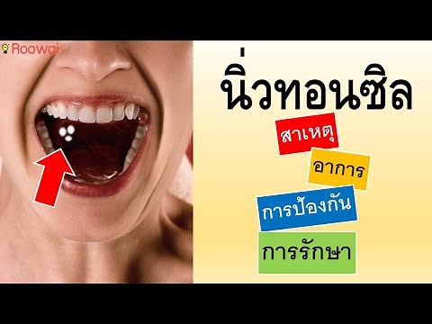 นิ่วทอนซิล ขี้ฟันในคอ เกิดจากอะไร เอาออกยังไง วิธีเอาออกง่ายๆ