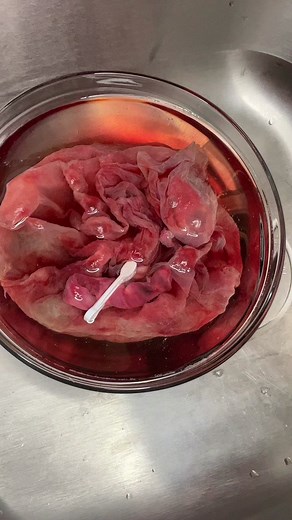 Placenta Encapsulation Process Explained in Detail