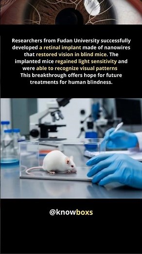 Retinal Nanowire Implant – A Breakthrough in Restoring Vision
