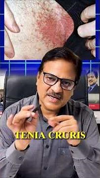 Fungal Infection prevention and treatment tips. #skincare #fungalinfection