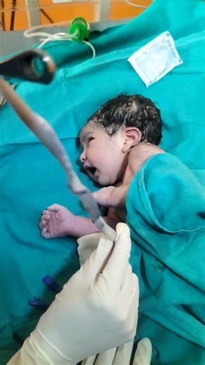 Umbilical cord cutting shorts #babyshorts #cutebaby #newbornbaby