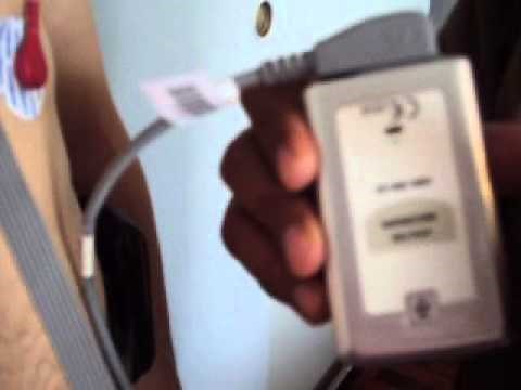 grabadoras holter ecg ritmo dms cardioscan como hago edito leo un holter cardiaco