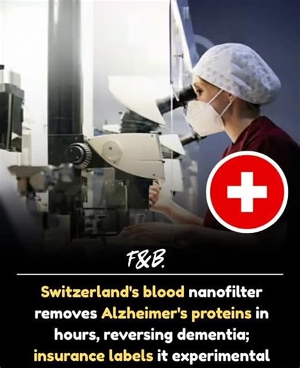 Anna Victoria on Instagram: "Swiss researchers have developed a groundbreaking blood-filtration device designed to remove toxic Alzheimer’s proteins amyloid-beta and tau directly from the bloodstream. These proteins accumulate in the brain, driving cognitive decline, but early clinical trials show that filtering them out can lead to noticeable improvements in memory and thinking within weeks. The device operates at a molecular level, with nanofilter pores engineered to trap harmful proteins whil