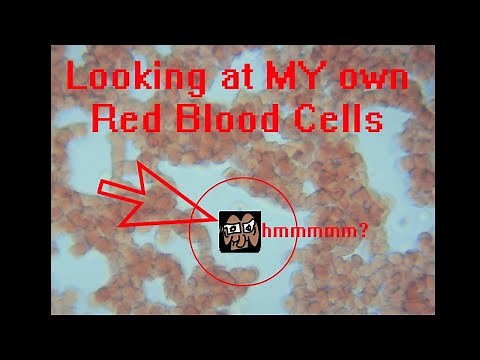 Agglutination of red blood cells