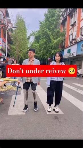 Amazing Prosthetic Leg Walking Skills | Real Life Prosthetic User