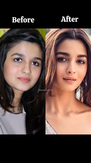 All Bollywood actress after and before look😍#bollywood #shorts #song #viral #trending #ytshorts