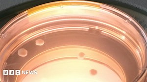 Human 'mini-brains' slow at developing among primates