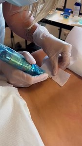 Say goodbye to unwanted skin tags the quick & effective way! ❄️ Cryotherapy gently freezes away skin tags, leaving smoother, clearer skin with minimal downtime. ✅ Precise & safe treatment ✅ Quick procedure ✅ Minimal discomfort ✅ Long-lasting results No more hiding or feeling self conscious… just confident skin. 📅 Book your consultation today and take the first step towards skin you feel great in! #Cryotherapy #SkinTagRemoval #ClearSkinJourney #SkinClinic #ConfidenceBoost #HealthySkin #SkinTreat